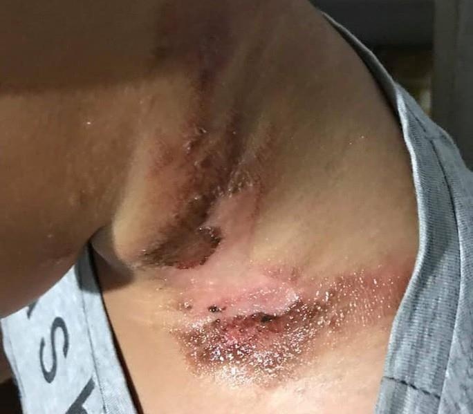 thuong lai thu mua bo doc 3 soc anh 2