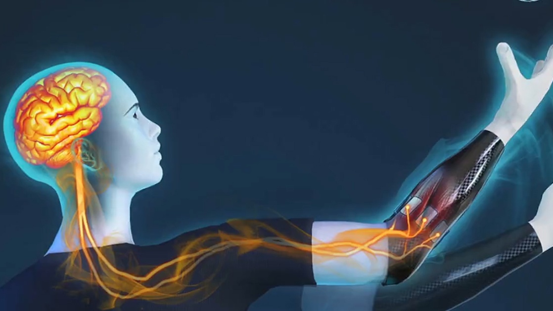 Cong nghe moi giup nguoi khuyet tat co canh tay nhu that hinh anh