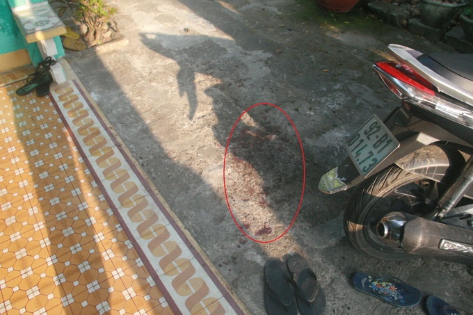 Ban vao ma nguoi yeu cho di cap cuu, xong... bo tron hinh anh