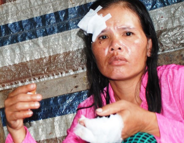 Dang ngoi xem tivi, doi vo chong bi chem toi tap hinh anh