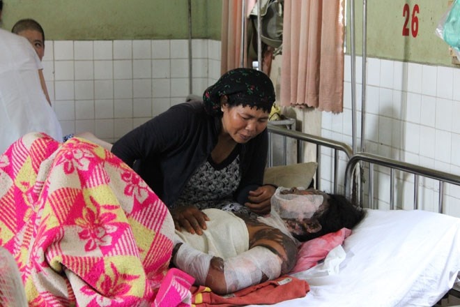 Bi an vu hai me con bi tat xang chay nhu duoc trong dem hinh anh