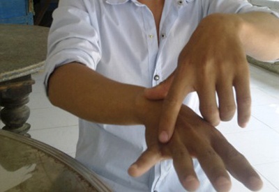 Cong an xa bi to kep dau ngon tay tre 10 tuoi hinh anh