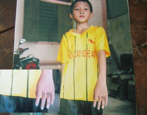 Can bo xa mat chim, cong an 'dung hinh' voi chau be 10 tuoi? hinh anh