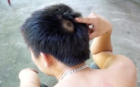 Bi nem gach vao dau, doi boi thuong 35 ty dong hinh anh