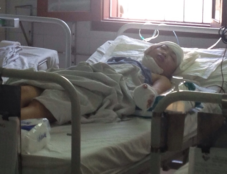 Tu van sau khi chem nguoi than lien tiep hinh anh