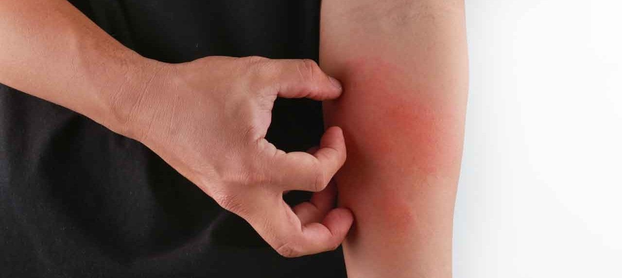 Ngua ngay toan than anh 1