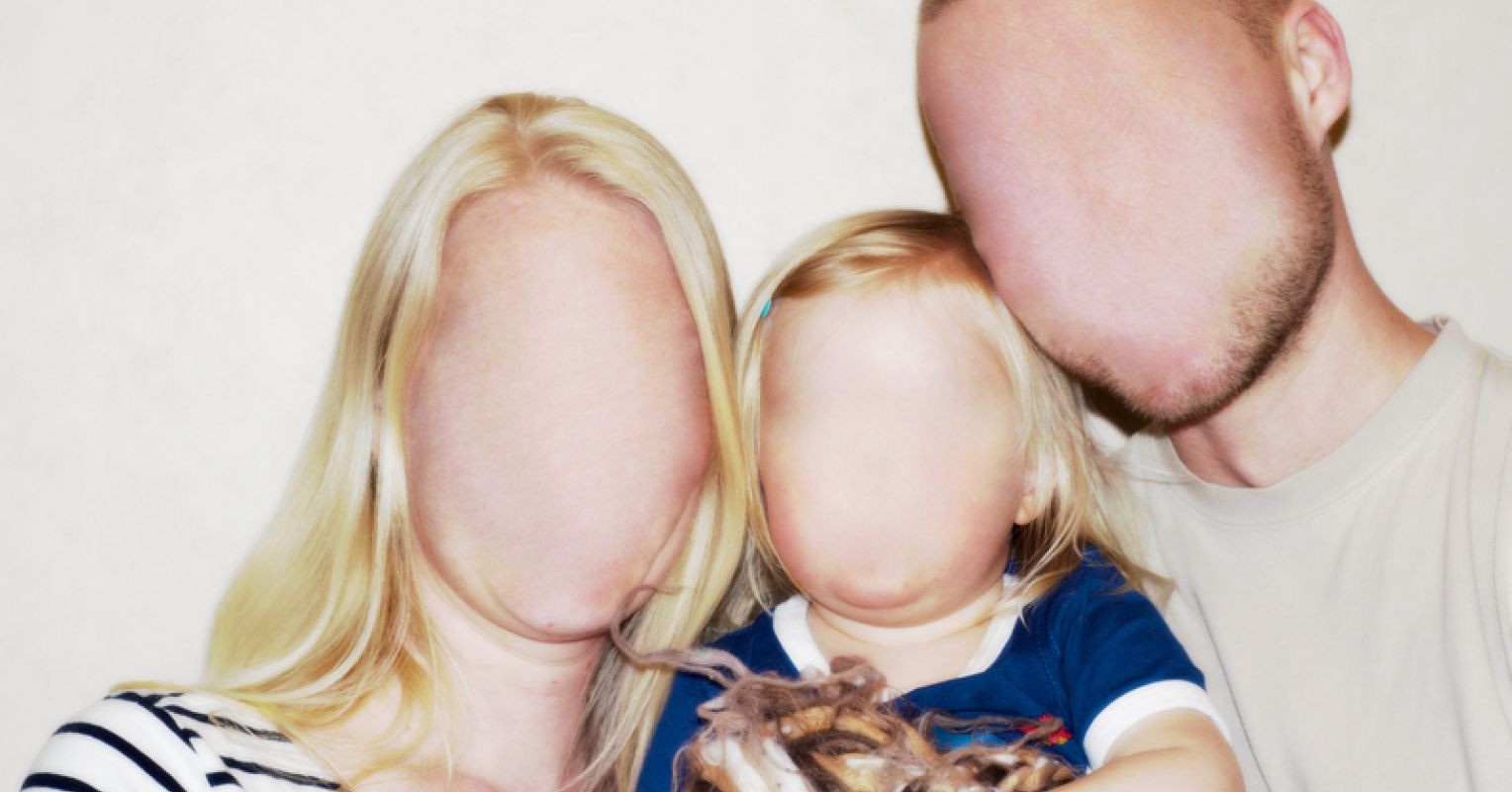 Covid-19 co the gay ra hoi chung mu mat hinh anh