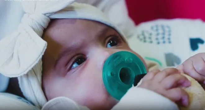 Tach roi thanh cong cap song sinh 5 thang tuoi hinh anh