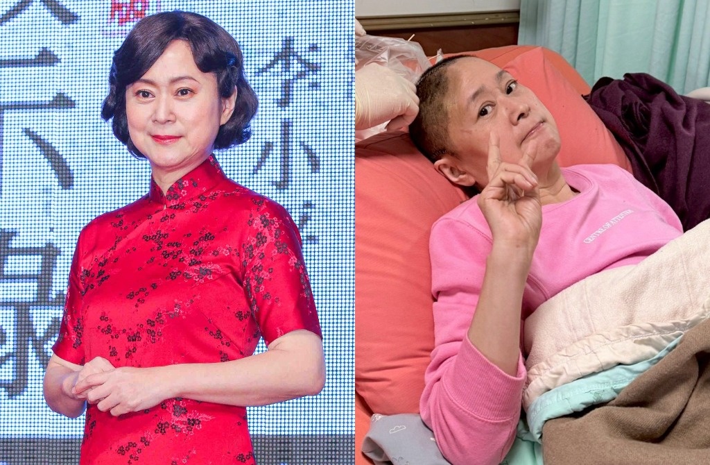 Dien vien 'Vuon sao bang' sau khi mat mot phan hop so hinh anh