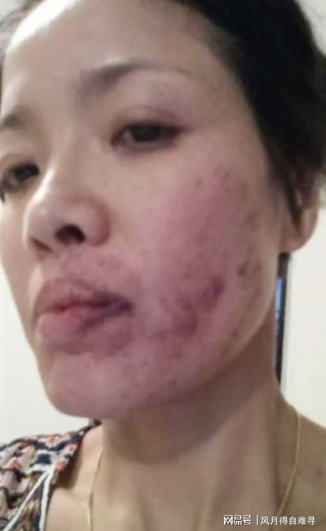 Bao Boi Nhu anh 1