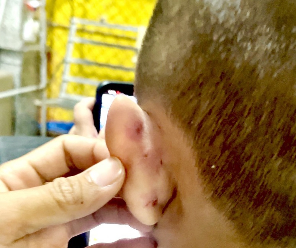 Khoi to co giao lam bi thuong be trai 4 tuoi hinh anh