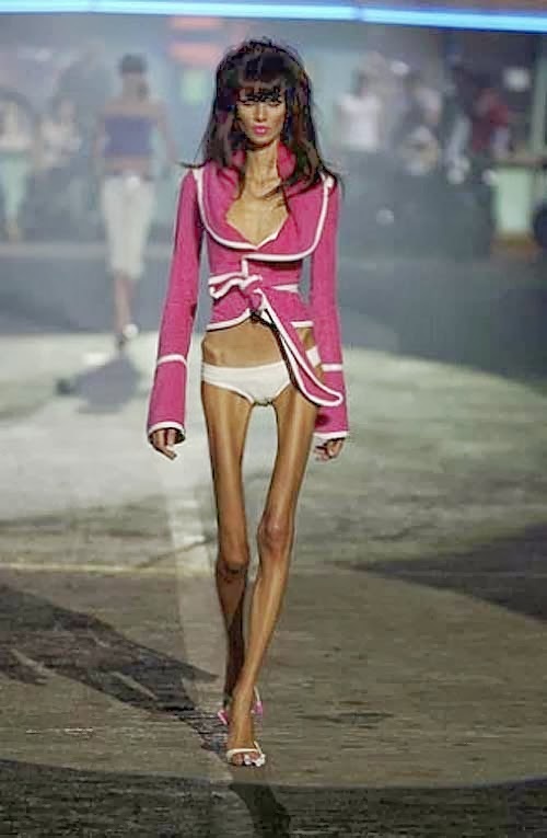 Nhung hinh anh gay soc cua nguoi mau sieu gay tren the gioi anh 2