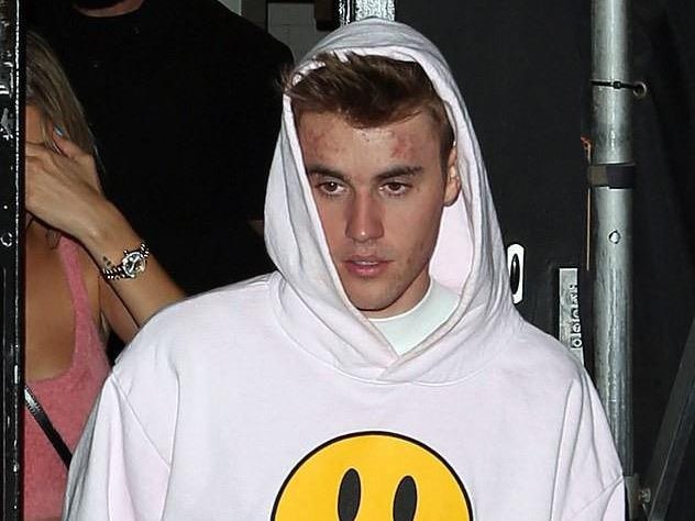 Da mun san sui nhu Justin Bieber, nam gioi nen cham soc the nao? hinh anh