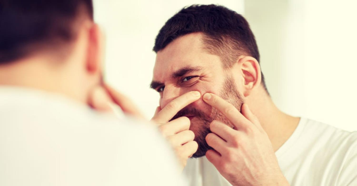 Cách trị da bị mụn như Justin Bieber ảnh 5 Cach tri da bi mun nhu Justin Bieber anh 5