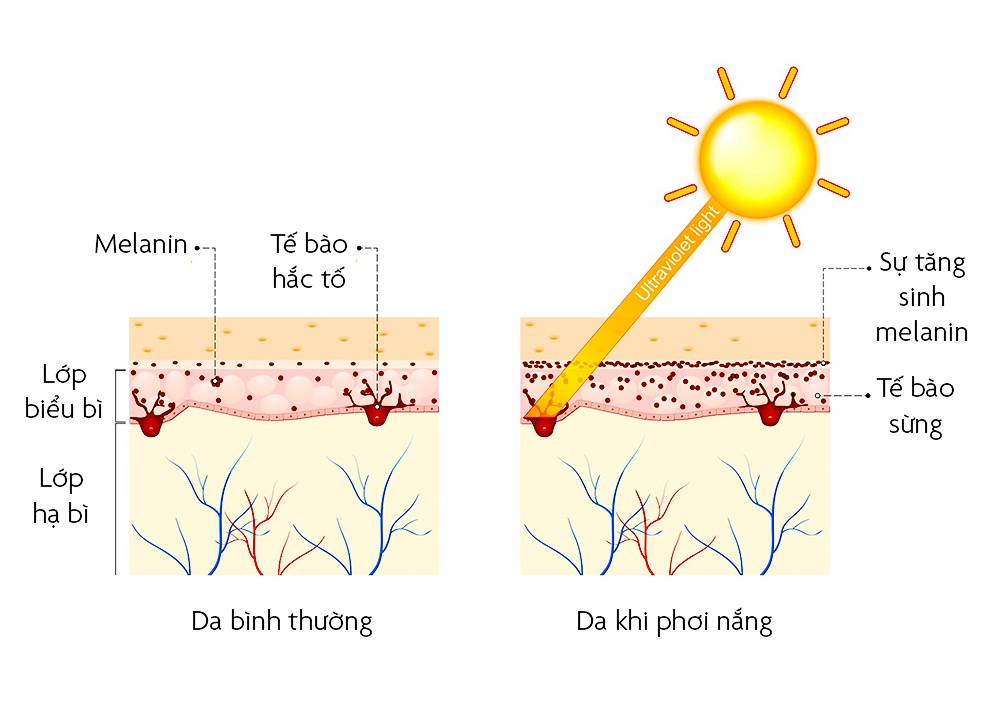 nguyên nhân khiến da nổi mụn ảnh 6 nguyen nhan khien da noi mun anh 6