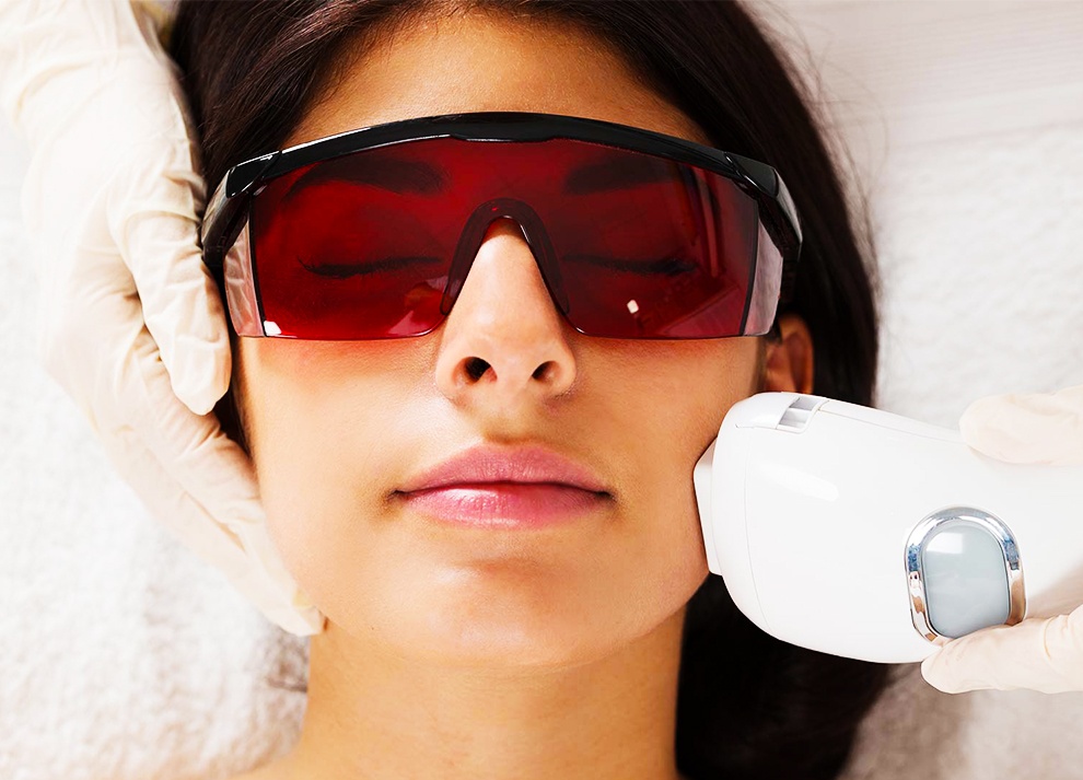 Kem chong nang anh 4