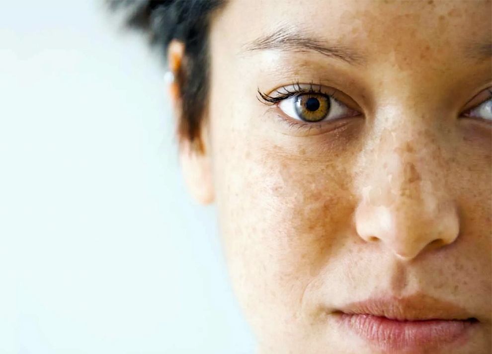 Kem chong nang anh 5