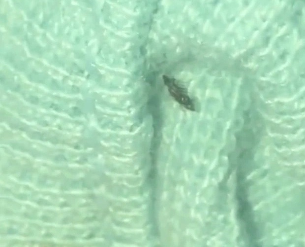 Bọ chét trong quần áo  ảnh 1 Bo chet trong quan ao anh 1