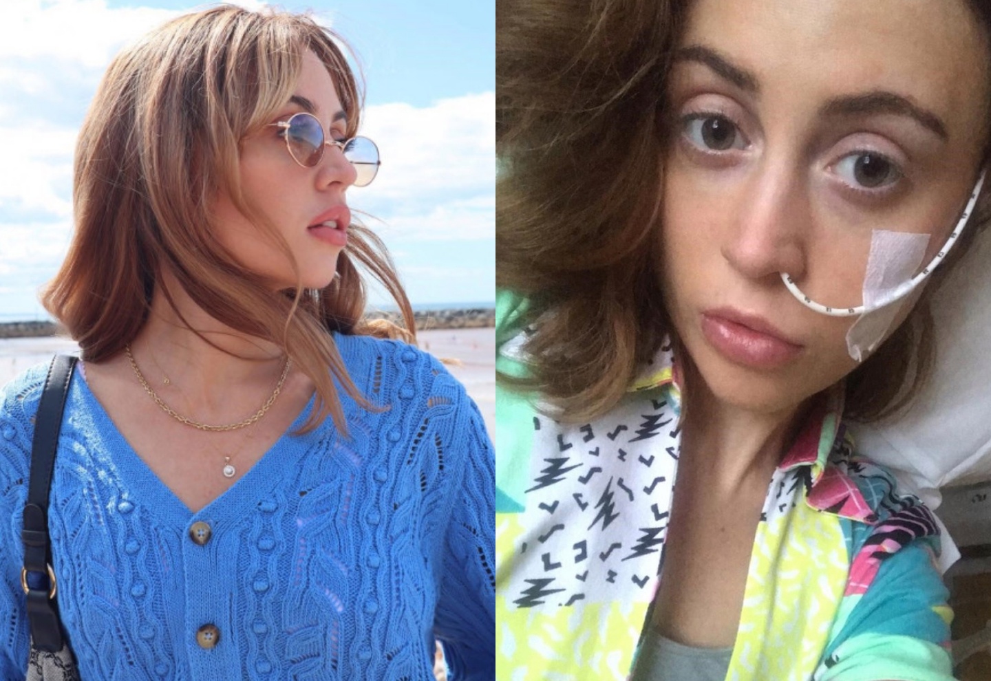 Nguoi mau Anh phau thuat cat bo vong mot o tuoi 24 hinh anh