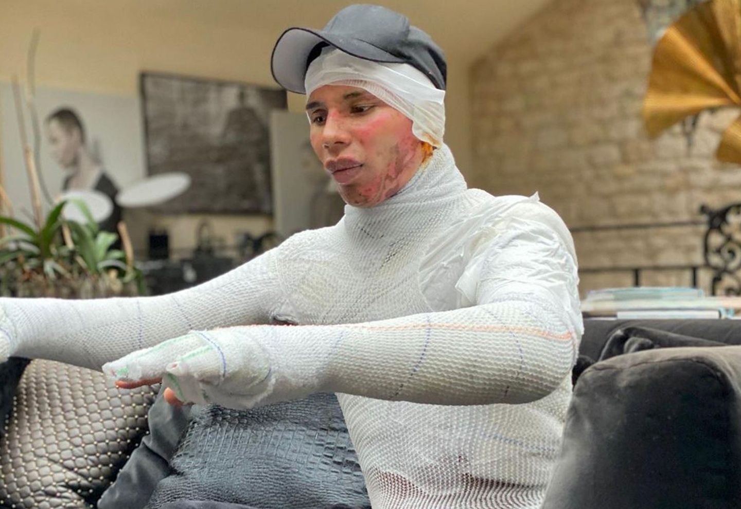 Nha thiet ke Balmain bi bong nang vi no lo suoi hinh anh