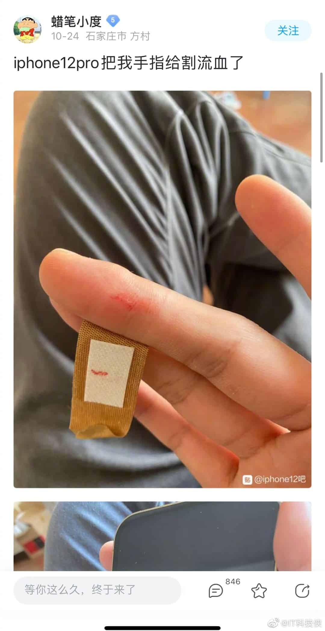 iPhone 12 khiến người dùng đứt tay ảnh 1 iPhone 12 khien nguoi dung dut tay anh 1