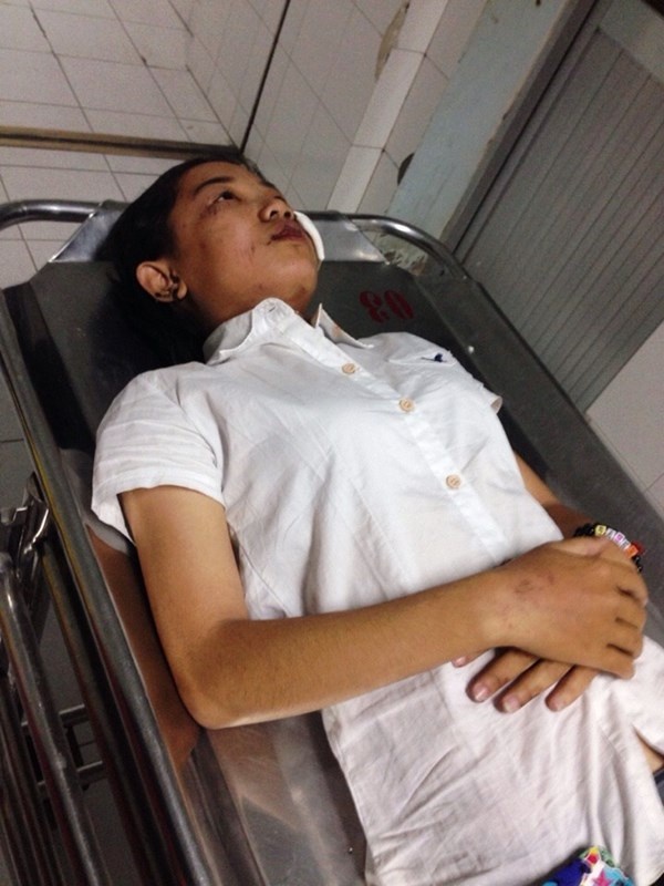 Em Nguyễn Kim Ánh hồi phục nhanh, chấn thương phần mềm, đang điều trị tích cực.