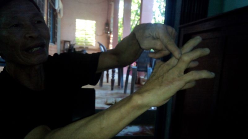 Ông Minh “tố” con trai hành hung khiến ngón tay ông bị tật nguyền. Ảnh: Quang Thành