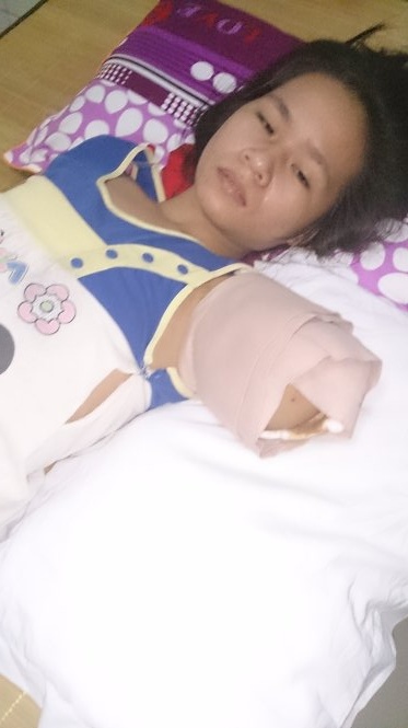 Ho nuoi vo dut canh tay mot nu du khach hinh anh