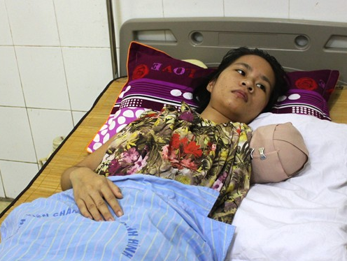 Khu du lich Trai Bo thua nhan nan nhan bi ho vo la du khach hinh anh