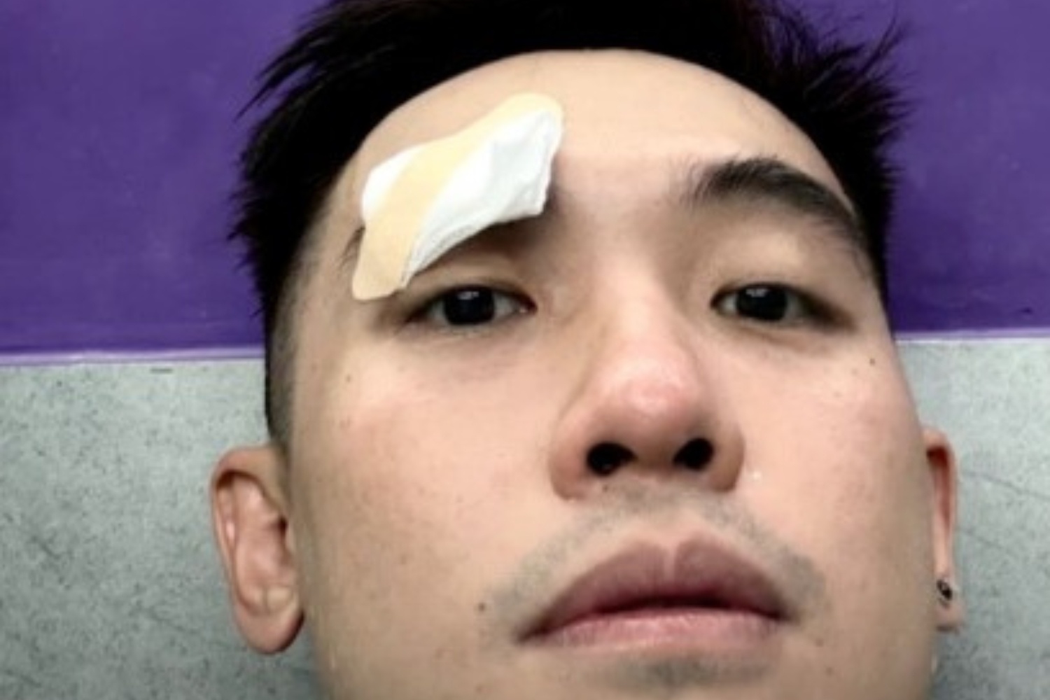 Pho Dac Biet bi thuong o dau khi choi cau long hinh anh