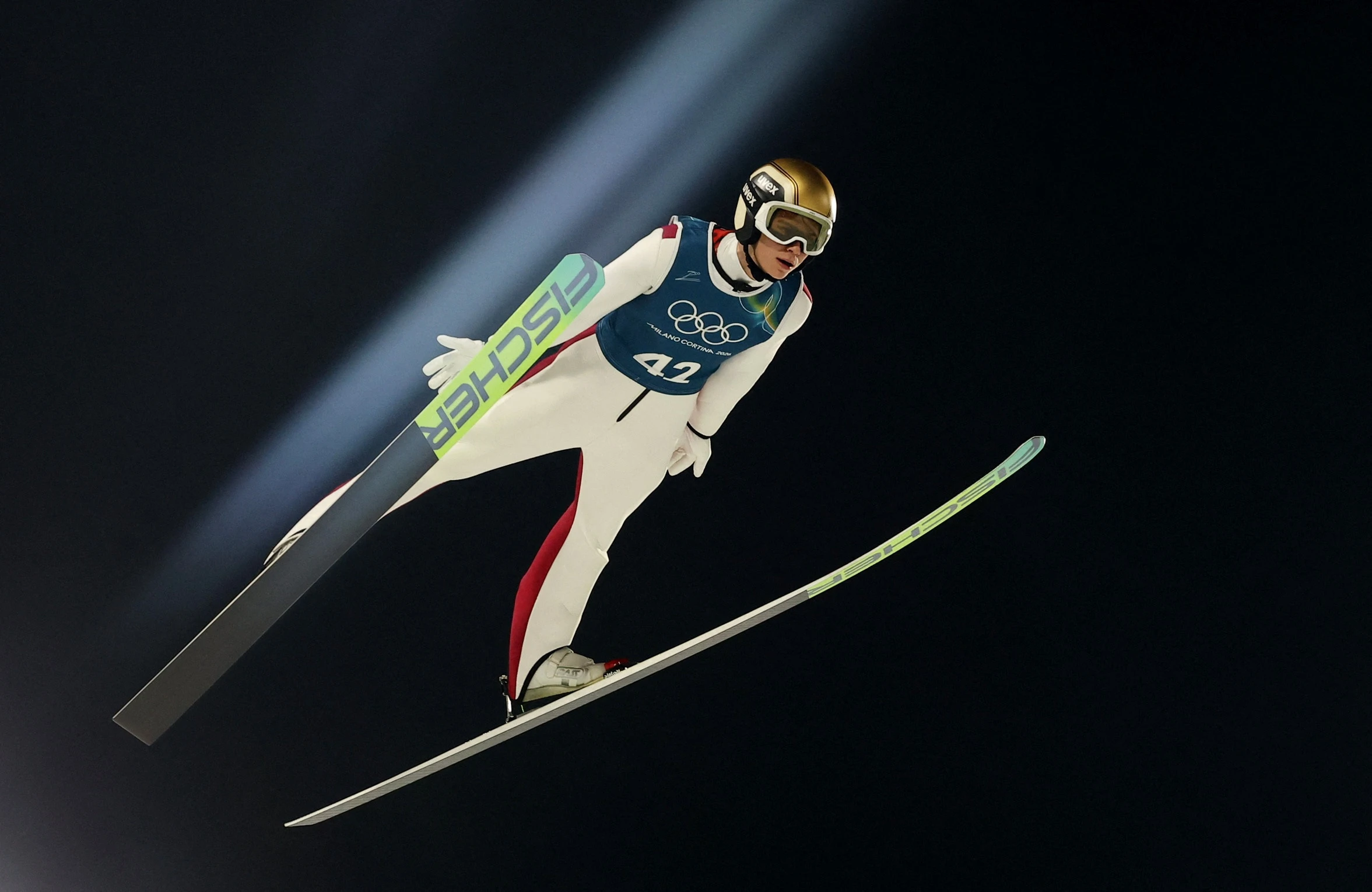 duong vat,  VDV,  axit,  tiem axit anh 1