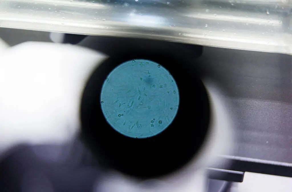 Ly do My tuot mat 20 trieu lieu vaccine dau mua khi hinh anh