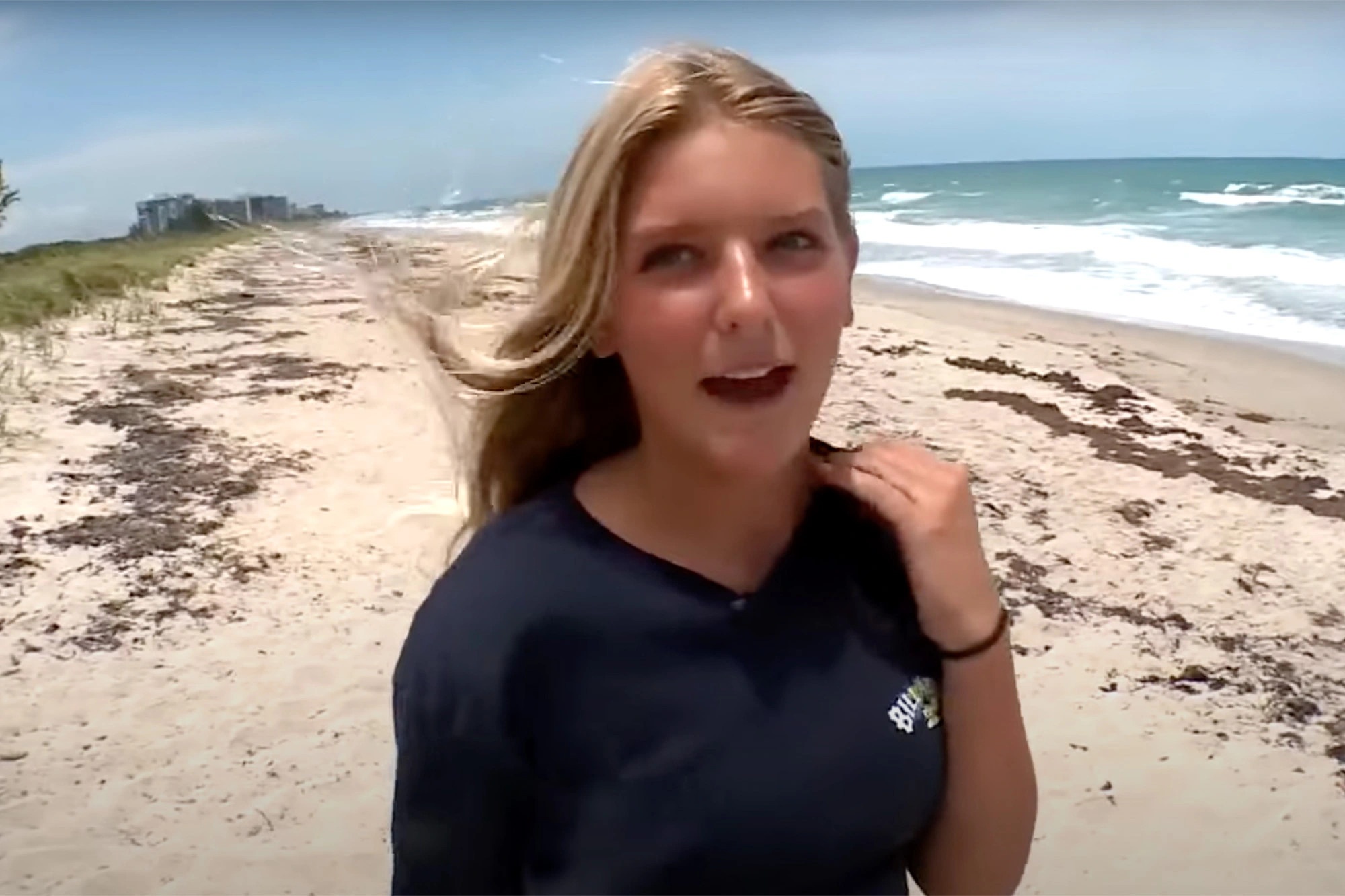 Be gai 13 tuoi bi ca map can vao bung o bai bien Florida hinh anh