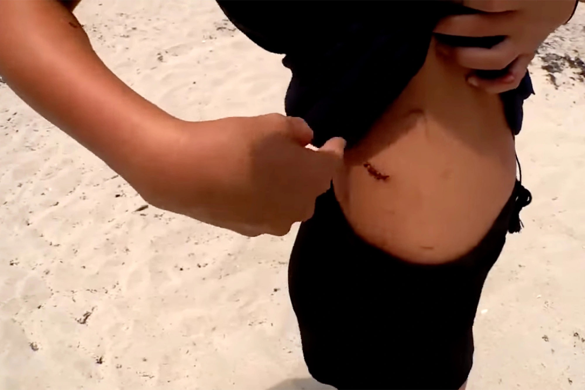 ca map tan cong anh 1