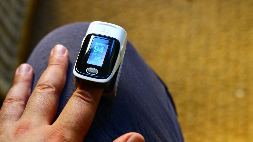 May do nong do SpO2 chua chac da chinh xac hinh anh