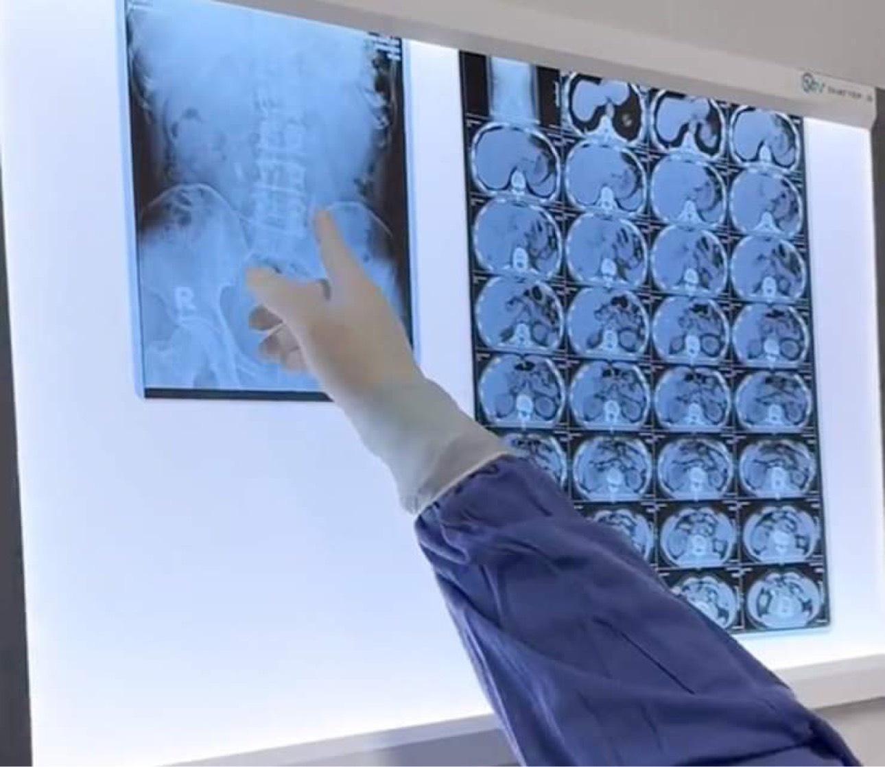 Nam thanh nien bi soi 'khung' khien than u mu hinh anh