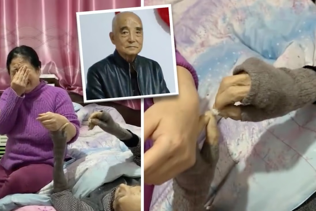 Nguoi cha hap hoi van co cham cuu chua benh cho con hinh anh
