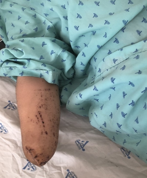 tai nan phao no anh 1