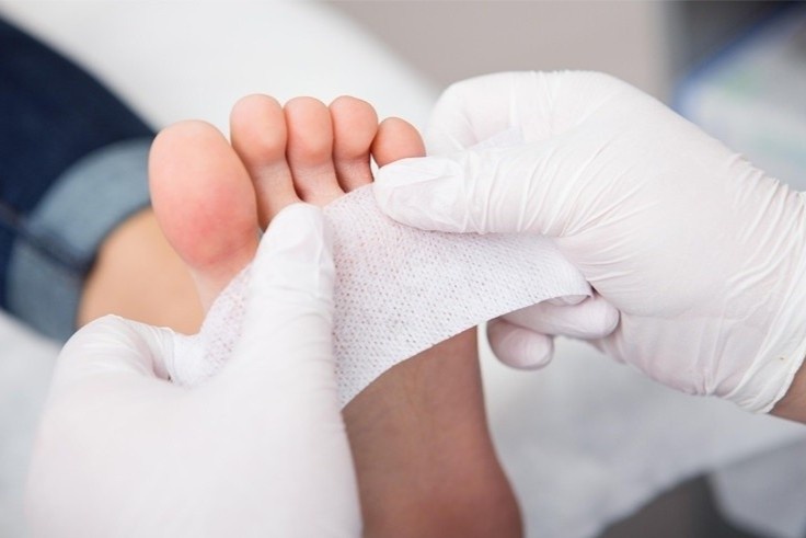 Dau hieu o chan canh bao mo mau cao bat thuong hinh anh