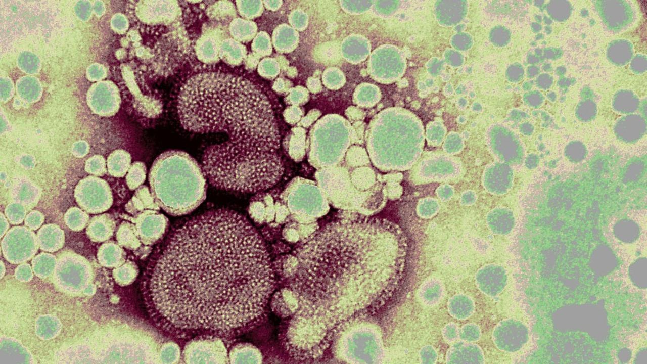 Khi nao cum gia cam co the lay nhiem cho nguoi? hinh anh