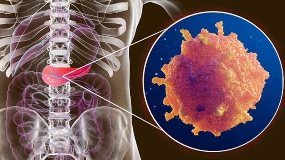 Can benh ung thu dang gia tang nhanh o phu nu hinh anh