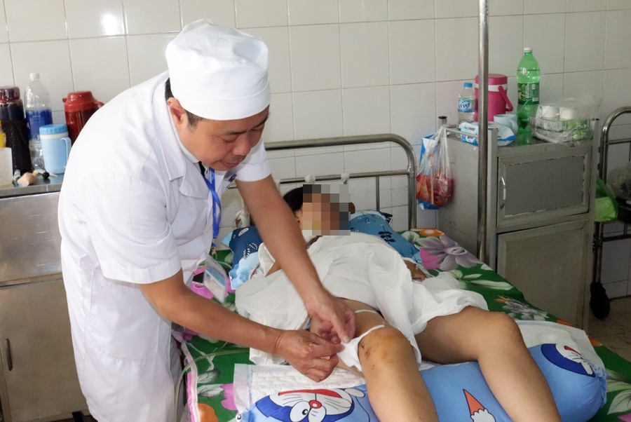 Cuu nu sinh bi chan thuong so nao, bien dang mat hinh anh