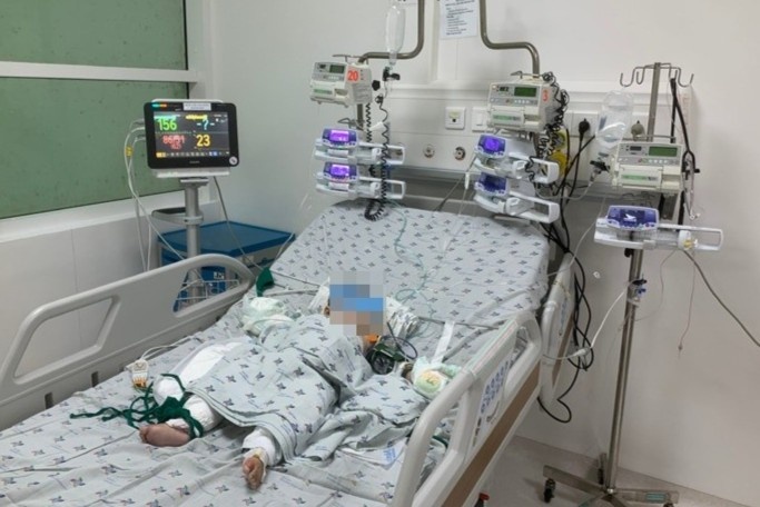 trẻ em bị phỏng ảnh 1 tre em bi phong anh 1