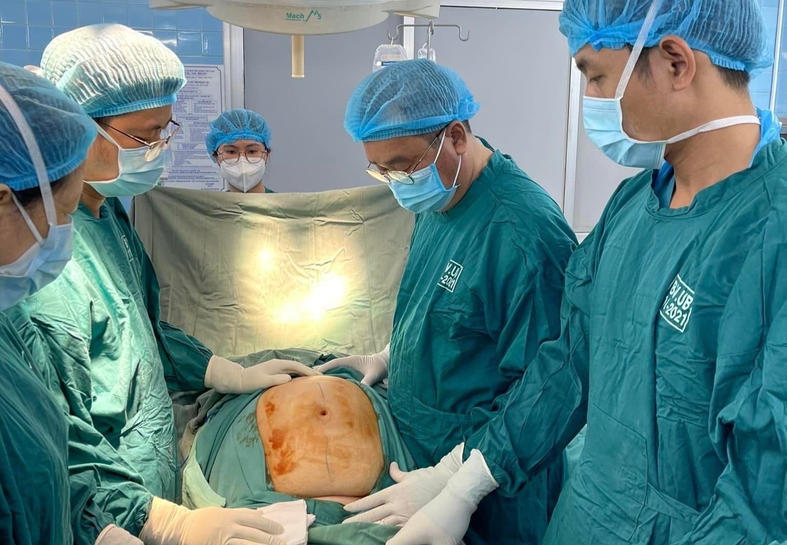 Cat khoi buou to 20 cm trong o bung nguoi phu nu hinh anh