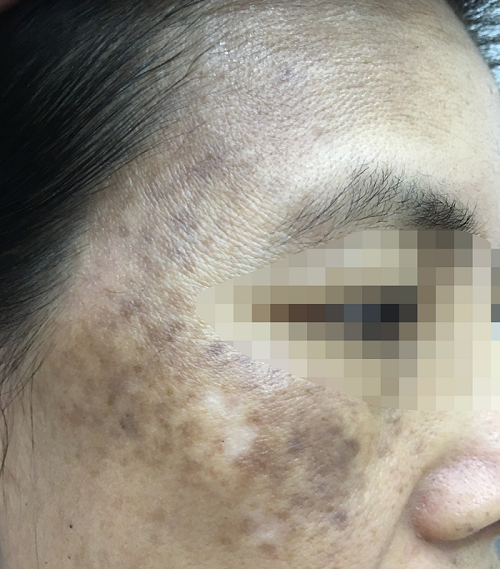 vien chong nang anh 1