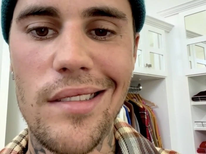 Can benh cua Justin Bieber hinh anh