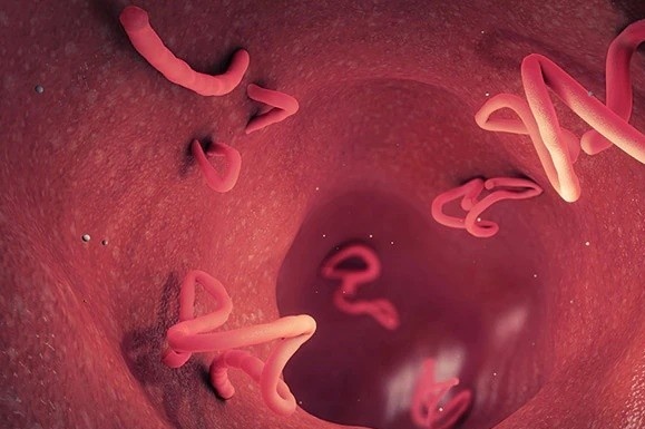 Dau hieu canh bao ban nhiem giun san hinh anh