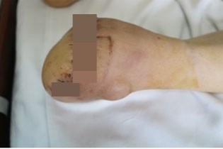 Phai thao bo nua ban chan vi chu quan hinh anh