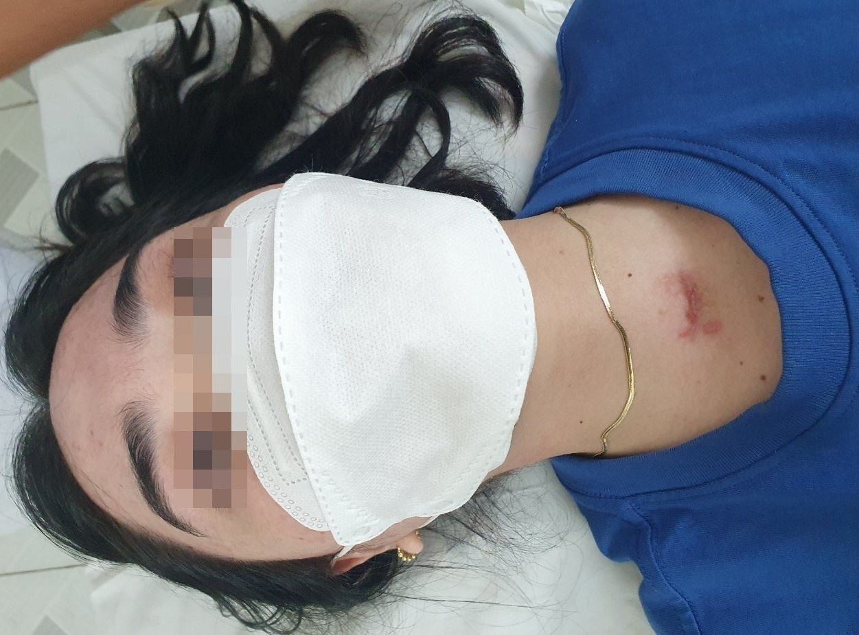 Can benh khien co gai 17 tuoi lien tuc kho tho hinh anh