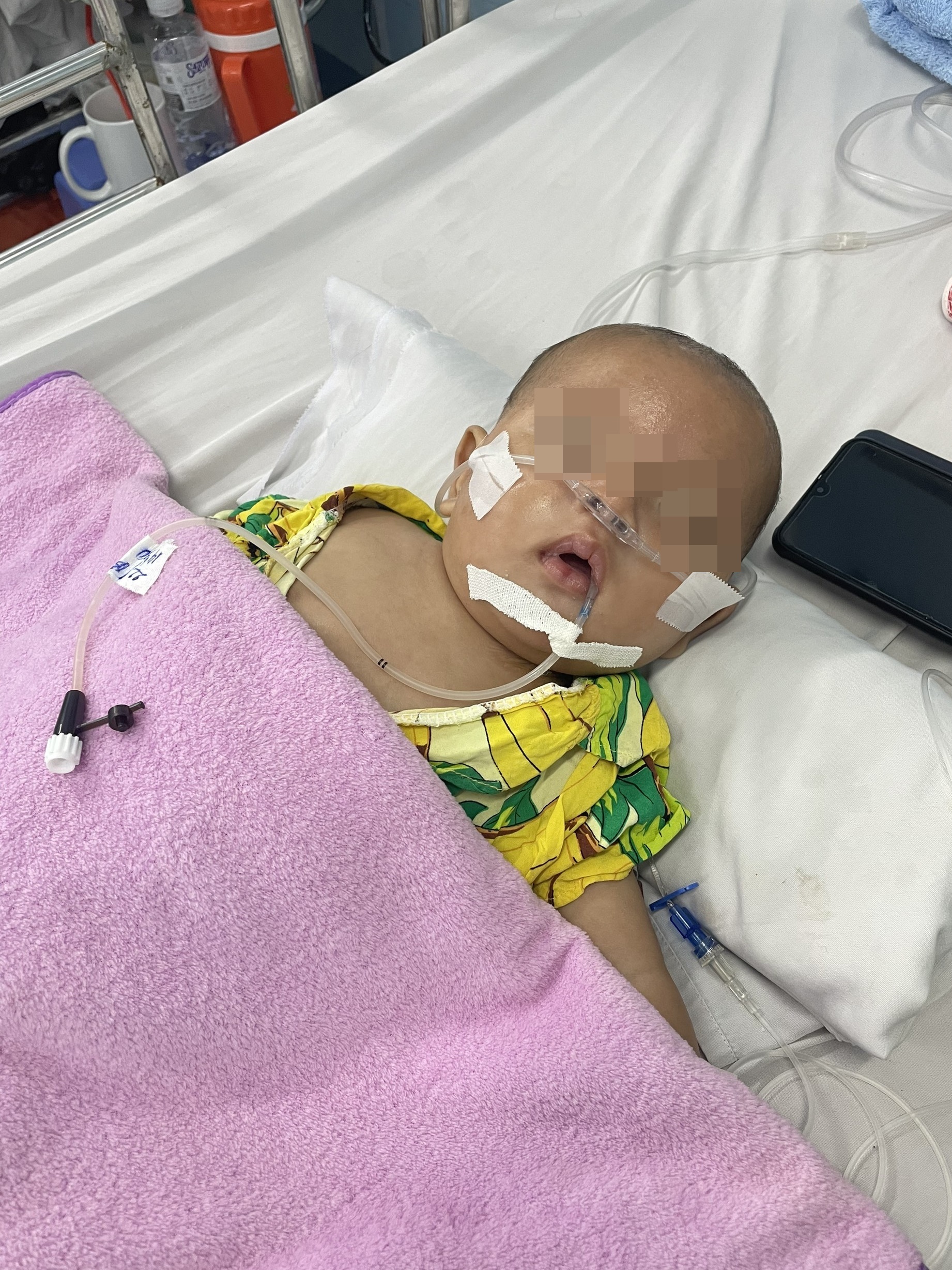 lao ở trẻ em ảnh 1 lao o tre em anh 1